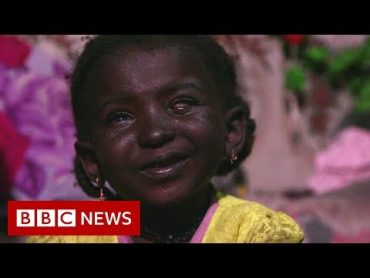 A Yemeni girl’s journey from cancer to recovery  BBC News