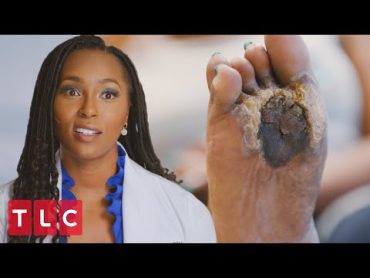 “Cursed Foot” Leaves Dr. Ebonie Stunned  My Feet Are Killing Me