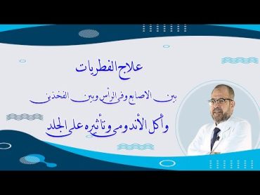 علاج الفطريات بين الاصابع, وفى الرأس, وبين الفخذين  واكل الاندومى وتأثيره على الجلد